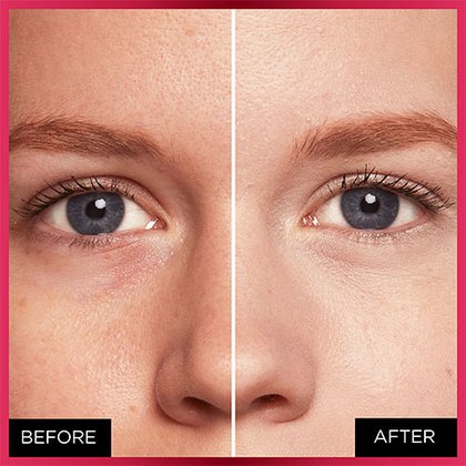 OAP MAKEUP FACE MTC BEFORE AFTER 320