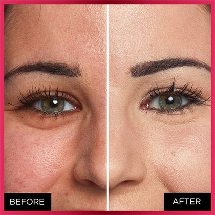 OAP MAKEUP FACE MTC BEFORE AFTER 325