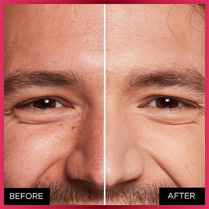 OAP MAKEUP FACE MTC BEFORE AFTER 330 1